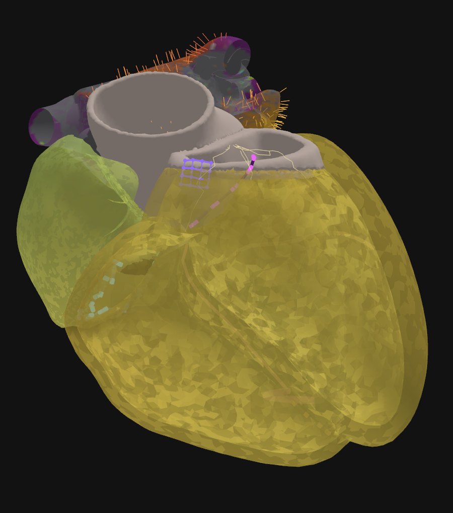 Four-chamber heart colored by activation state during ventricular depolarization